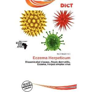  Eczema Herpeticum (9786200724670) Knútr Benoit Books