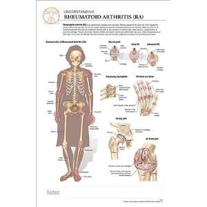   11 x 17 Post It Disease Chart RHEUMATOID ARTHRITIS 
